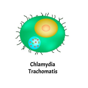 Chlamydia